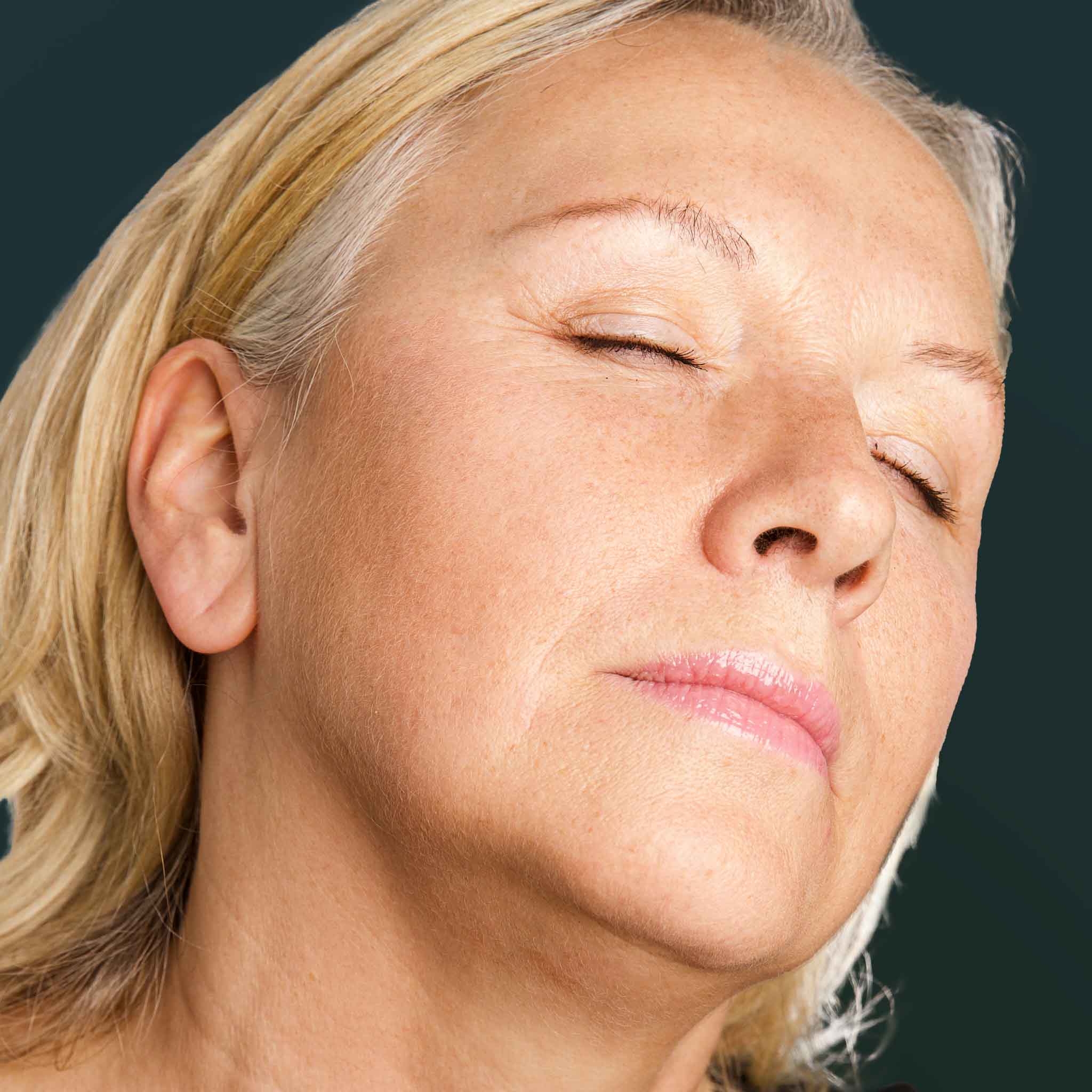 Blepharoplastik